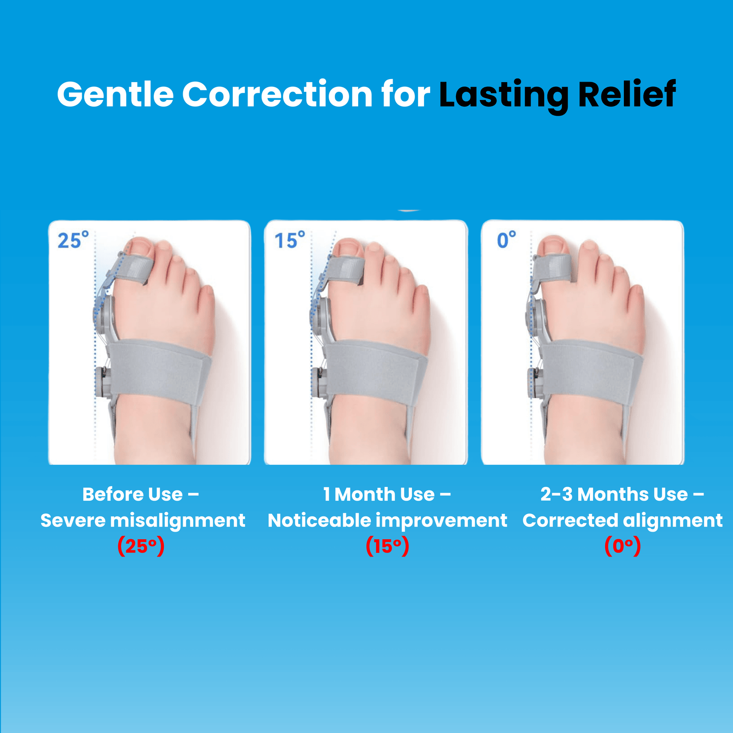 The Bliise™ Bunion Relief Brace