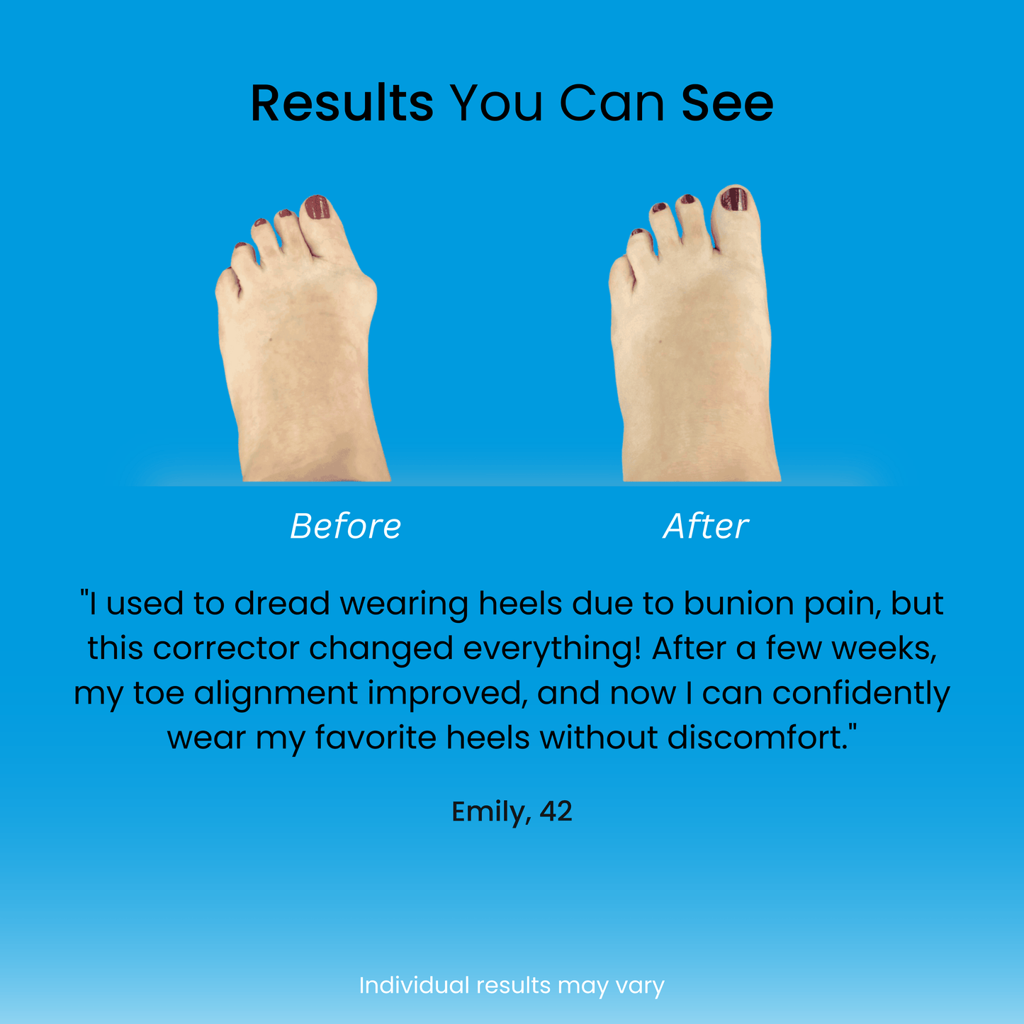 The Bliise™ Bunion Relief Brace
