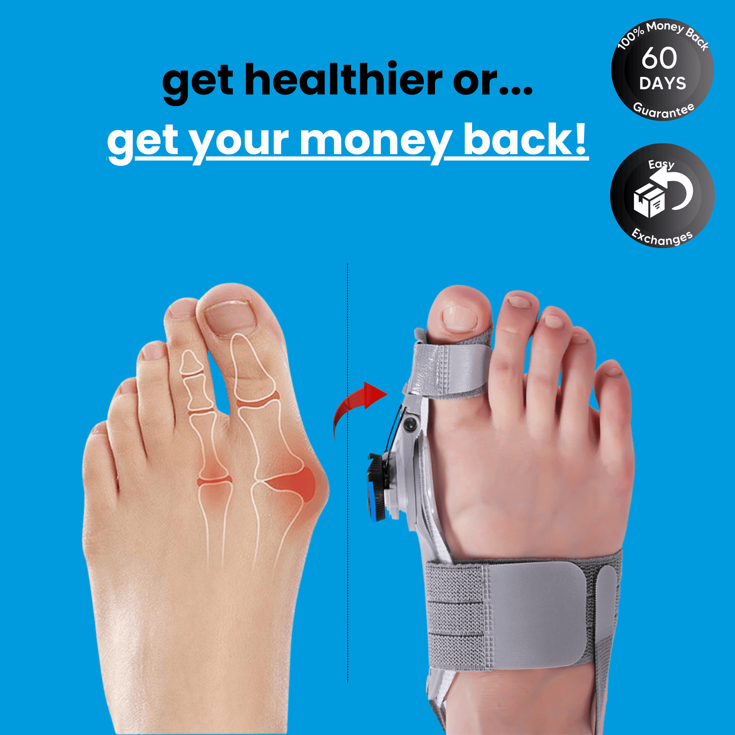 The Bliise™ Bunion Relief Brace